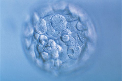 http://changzhou.quanwangkm.com/post/190.html|常州人工试管